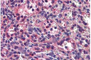 Human Spleen: Formalin-Fixed, Paraffin-Embedded (FFPE) (Septin 8 antibody  (AA 1-259))