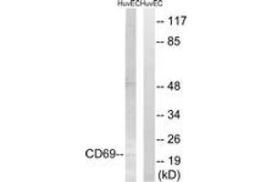 Western blot analysis of extracts from HuvEc cells, using CD69 Antibody. (CD69 antibody  (AA 101-150))