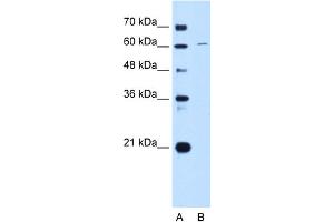 WB Suggested Anti-CDT1 Antibody Titration:  0. (CDT1 antibody  (C-Term))