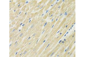 Immunohistochemistry of paraffin-embedded Rat heart using SLC19A1 Polyclonal Antibody at dilution of 1:100 (40x lens). (SLC19A1 antibody)