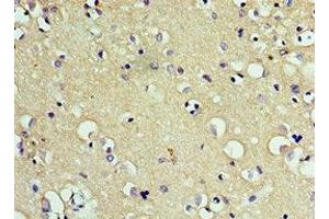 Immunohistochemistry of paraffin-embedded human brain tissue using ABIN7147323 at dilution of 1:100 (CD200R1 antibody  (AA 226-325))