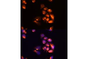 Immunofluorescence analysis of Hela cells using TIM-3/H antibody (ABIN6134185, ABIN6141626, ABIN6141630 and ABIN6217441) at dilution of 1:100 (40x lens). (TIM3 antibody  (AA 1-100))
