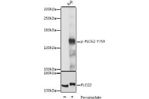 Western blot analysis of extracts of Raji cells, using Phospho-PLC gamma 2 (PLCG2)-Y759 antibody (ABIN7269341) at 1:2000 dilution or PLC gamma 2 (PLCG2) antibody (ABIN3023144, ABIN3023145, ABIN3023146 and ABIN6219411). (Phospholipase C gamma 2 antibody  (pTyr759))