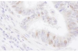 anti-PCNA Clamp Associated Factor (PAF) (AA 61-111) antibody