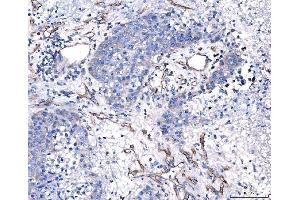 IHC analysis of CD93 using anti-CD93 antibody (ABIN7602865). (CD93 antibody  (C-Term))