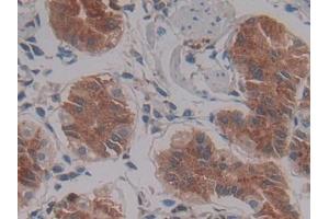 DAB staining on IHC-P; Samples: Human Stomach Tissue (LEFTY1 antibody)