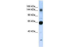 WB Suggested Anti-COL11A2 Antibody Titration:  0.