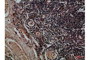 Immunohistochemical analysis of paraffin-embedded Human-tonsil, antibody was diluted at 1:100 (KIR2DL5A antibody  (AA 31-80))