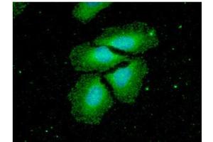 ICC/IF analysis of NME2 in HeLa cells. (NME2 antibody  (AA 1-152))
