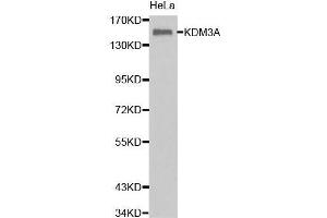 Western Blotting (WB) image for anti-Lysine (K)-Specific Demethylase 3A (KDM3A) (AA 1-300) antibody (ABIN1680576) (KDM3A antibody  (AA 1-300))