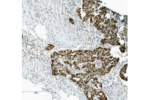 IHC analysis of PTBP2 using anti-PTBP2 antibody (ABIN7599453). (PTBP2 antibody  (AA 1-504))