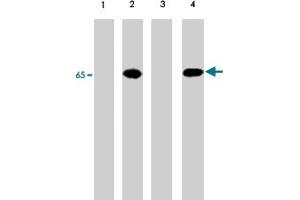 Western blot of A-431 cells untreated (lanes 1) or treated with pervanadate (lanes 2, 3 & 4). (PDPK1 antibody  (pTyr9))
