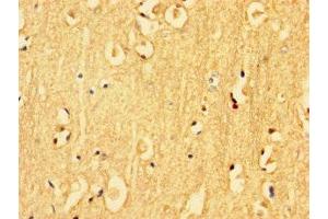 Immunohistochemistry of paraffin-embedded human brain tissue using ABIN7157217 at dilution of 1:100 (Kallikrein 6 antibody  (AA 22-244))
