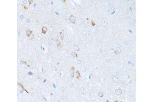 Immunohistochemistry of paraffin-embedded Rat brain using SERPINA3 Polyclonal Antibody at dilution of 1:100 (40x lens). (SERPINA3 antibody)