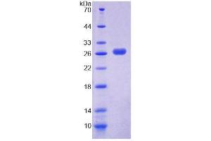 SDS-PAGE analysis of Mouse PEX1 Protein. (PEX1 Protein)