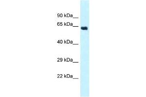 WB Suggested Anti-CYP4Z1 Antibody Titration: 1. (CYP4Z1 antibody  (Middle Region))