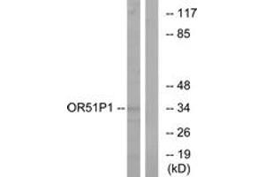 Western blot analysis of extracts from Jurkat cells, using OR51D1 Antibody. (OR51D1 antibody  (AA 33-82))