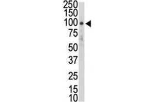 Western blot analysis of DDR2 antibody and HL-60 lysate. (DDR2 antibody  (AA 290-320))