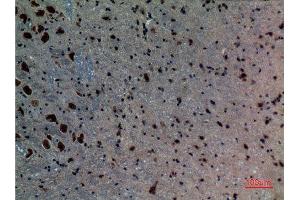 Immunohistochemistry (IHC) analysis of paraffin-embedded Mouse Brain, antibody was diluted at 1:100. (ACVRL1 antibody  (N-Term))