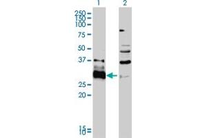 Western Blot analysis of HDGFRP3 expression in transfected 293T cell line by HDGFRP3 monoclonal antibody (M01), clone 2G12. (HDGFRP3 antibody  (AA 1-203))