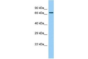 Host: Rabbit Target Name: BTBD18 Sample Type: 721_B Whole Cell lysates Antibody Dilution: 1. (BTBD18 antibody  (C-Term))