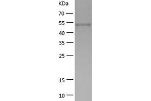 Western Blotting (WB) image for MNT, MAX Dimerization Protein (MNT) (AA 1-465) protein (His tag) (ABIN7287851) (MNT Protein (AA 1-465) (His tag))