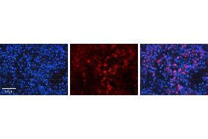 Immunohistochemistry (IHC) image for anti-BCL2-Antagonist/killer 1 (BAK1) (N-Term) antibody (ABIN2779335)