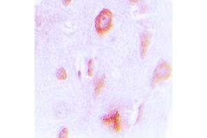 Immunohistochemical analysis of Cytochrome P450 4X1 staining in human brain formalin fixed paraffin embedded tissue section. (CYP4X1 antibody  (Center))