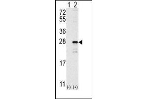 Image no. 1 for anti-GTPase NRas (NRAS) (C-Term) antibody (ABIN360039) (GTPase NRas antibody  (C-Term))