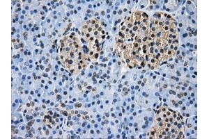 Immunohistochemical staining of paraffin-embedded Ovary tissue using anti-GBE1 mouse monoclonal antibody.