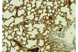ABIN6274431 at 1/100 staining Mouse lung tissue by IHC-P. (PPHLN1 antibody  (N-Term))