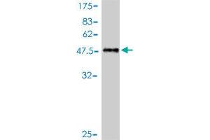 Western Blot detection against Immunogen (49. (RAB39B antibody  (AA 1-213))