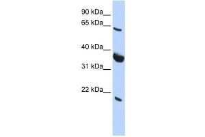 Western Blotting (WB) image for anti-Signal Recognition Particle Receptor (Docking Protein) (SRPR) antibody (ABIN2458501) (SRPR antibody)