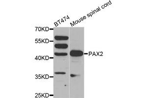 Western blot analysis of extracts of various cell lines, using PAX2 antibody (ABIN1874046) at 1:500 dilution. (PAX2A antibody)