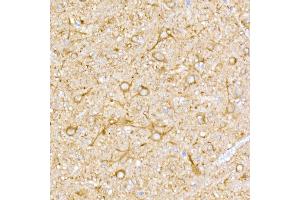 Immunohistochemistry of paraffin-embedded rat brain using NgR3 Rabbit mAb (ABIN7269932) at dilution of 1:50 (40x lens). (RTN4RL1 antibody)