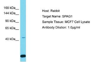 Host: Rabbit Target Name: SPAG1 Sample Tissue: Human MCF7 Whole Cell Antibody Dilution: 1ug/ml (SPAG1 antibody  (N-Term))