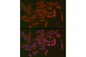 Immunofluorescence (IF) image for anti-Polymeric Immunoglobulin Receptor (PIGR) (AA 661-764) antibody (ABIN6145618)