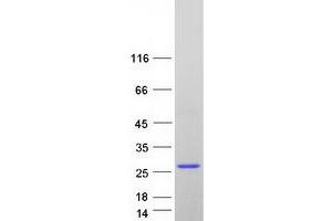 Validation with Western Blot (FAIM Protein (Transcript Variant 3) (Myc-DYKDDDDK Tag))