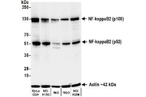 Western Blotting (WB) image for anti-NF-KappaB2 (/p52) (AA 1-50) antibody (ABIN7795782) (Recombinant NF-KappaB2 (/p52) (AA 1-50) antibody)