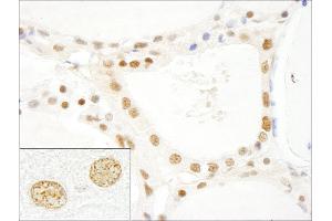 Immunohistochemistry (IHC) image for anti-LUC7-Like 3 (LUC7L3) (AA 1-50) antibody (ABIN7448489) (LUC7-Like 3 antibody  (AA 1-50))