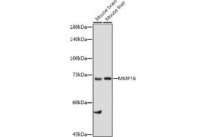 Western blot analysis of extracts of various cell lines, using MMP16 antibody (ABIN6132356, ABIN6143906, ABIN6143907 and ABIN6214654) at 1:1000 dilution. (MMP16 antibody  (AA 290-565))