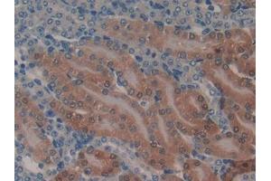 DAB staining on IHC-P; Samples: Mouse Kidney Tissue (GSTA1 antibody  (AA 2-223))