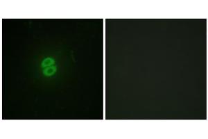 Immunofluorescence analysis of A549 cells, using CD253 antibody. (TRAIL antibody  (Internal Region))