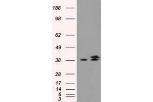 HEK293T cells were transfected with the pCMV6-ENTRY control (Left lane) or pCMV6-ENTRY IDH3A (Right lane) cDNA for 48 hrs and lysed. (IDH3A antibody)