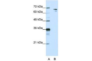 WB Suggested Anti-SF1  Antibody Titration: 1. (Splicing Factor 1 antibody  (N-Term))