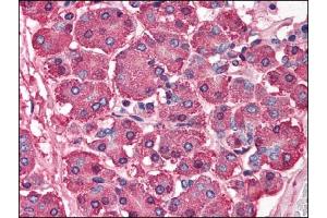 Image no. 1 for anti-SKI Proto-Oncogene (SKI) (N-Term) antibody (ABIN303247) (SKI antibody  (N-Term))