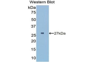 Western Blotting (WB) image for anti-HLA Class II DR alpha (HLA-DRA) (AA 28-232) antibody (ABIN1175589)