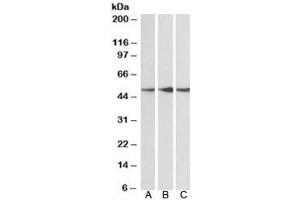 Western blot testing of human cerebellum [A], mouse [B] and rat [C] brain lysate with PPP2R5E antibody at 0. (PPP2R5E antibody)