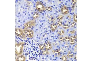 Immunohistochemistry of paraffin-embedded rat kidney using GIP antibody. (GIP antibody)