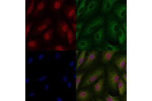 ABIN6257418 and ABIN6273806 staining  cells by IF/ICC.